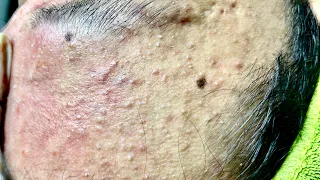 Satisfying video with Chung Vo Spa | 425