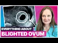 Blighted Ovum Explained Causes Diagnosis and What to Do Next
