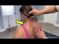 Another Surprise Trapezius KNOT Feels Like Water Balloon - Will Cracks Be Enough To Help Dr Ed