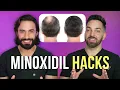 Minoxidil Hair Growth Hacks That Will Change Your Life Doctorly Tips