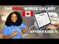 My Nurse Salary in Canada Before vs After Taxes