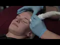 RF Heracare-апарат для омолодження шкіри
