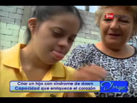 Criar un hijo con síndrome de down capacidad que enriquece el corazón