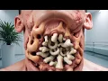 Download Lagu ASMR Deep Cleaning of Skin Pustules | Oddly Satisfying Animation