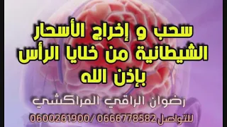 رقية قوية بإذن الله لسحب وإخراج الأسحار الشيطانية من خلايا الرأس رضوان الراقي المراكشي 0600261900 