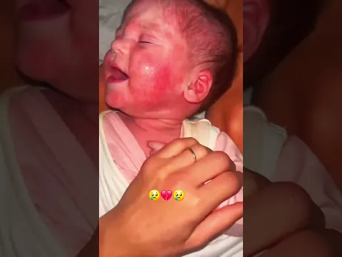 #baby