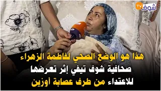هذا هو الوضع الصحي لفاطمة الزهراء صحافية شوف تيفي إثر تعرضها للاعتداء من طرف عصابة أوزين