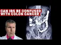 IBS vs Colon Cancer Understanding the Differences and Similarities