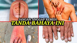 Tanda di Tubuh yang Sebaiknya Jangan Pernah Kamu Abaikan
