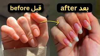 تطويل الاظافر بسررررعة في 3 ايام l قصتي مع اظافري القصيرة