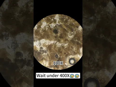 wait for it😱😳