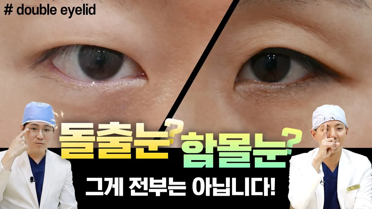 함몰 눈, 돌출 눈! 어떻게 해야 쌍꺼풀 수술 대박날까?