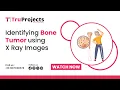 Identifying Bone Tumor using X Ray Images Btech Projects with Source Code and Document