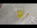 Urine Sample Collection Process for At-Home Lab Test KED Kit