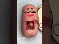 Download Lagu Goodland |The sausage operation 😂 #goodland #Fruitsurgery #doodles