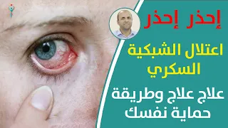 اعتلال الشبكية السكري انتبهوا لعيونكم فالسكري قد يؤذيها   اضرار مرض السكر يسببها مرض السكري للعين دندنها