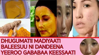 DHUGUMATII MADIYAATI BALEESUU NI DANDEENA YEEROO GABABAA KEESSAATI 