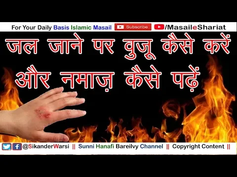 Hath Jala Hua Ho To Wuzu Kaise Karen | Zamkh Se Mawad Nikalta Hai Aur Kapde Par Lage To Namaz Hogi