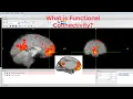 CONN Tutorial What is Functional Connectivity