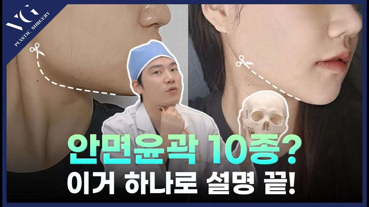 #안면윤곽 10종? 박원장님이 알려주는 안면윤곽의 모든것🤭
