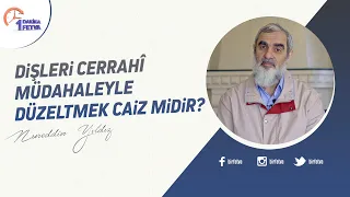 Dişleri cerrahî müdahaleyle düzeltmek caiz midir?