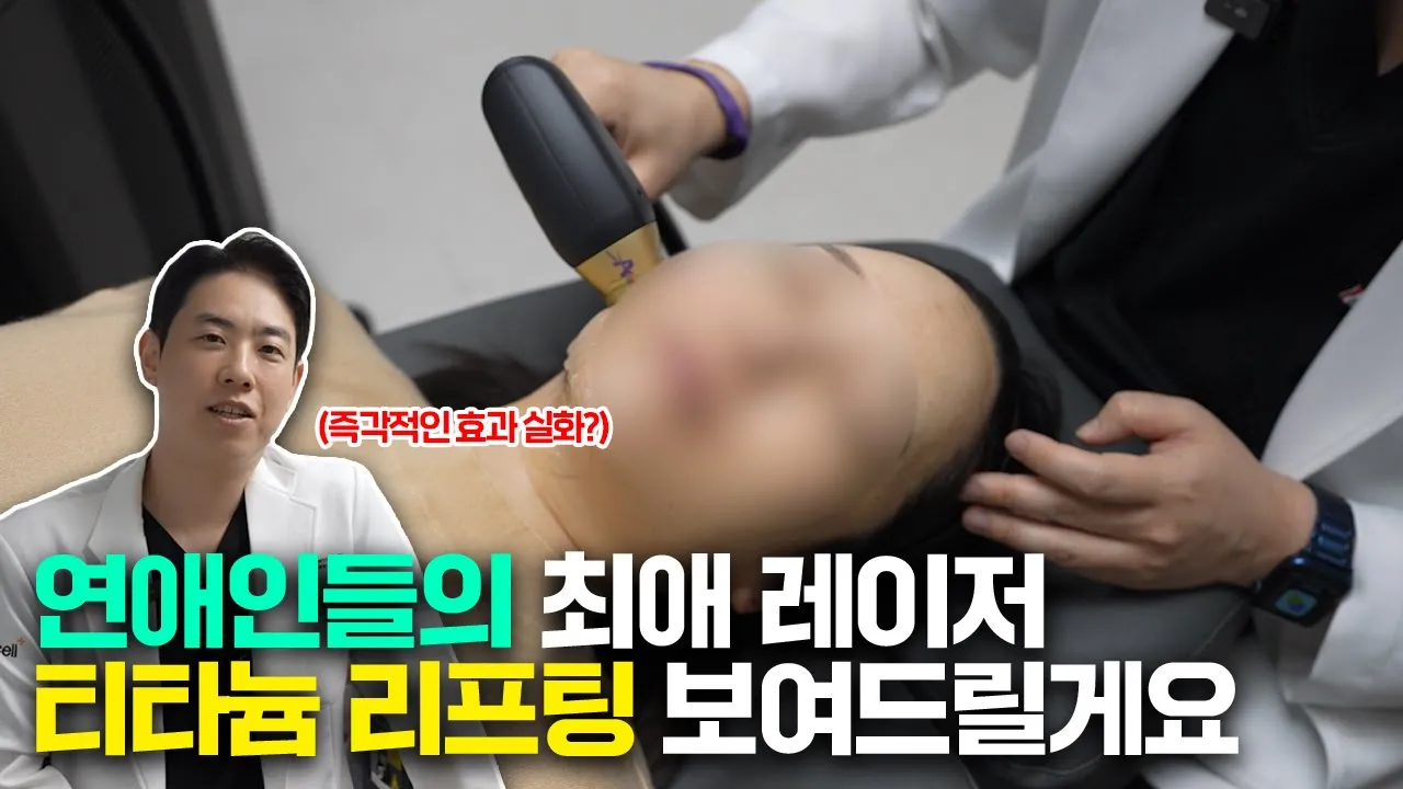티타늄리프팅 1회 효과 직접 보여드리겠습니다 / 티타늄리프팅 실제 시술 후기!