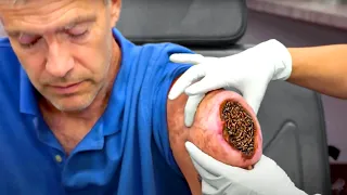 something big is stuck in his arm...
