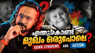 ⁉️എന്തുകൊണ്ട് മുഖം ഒരുപോലെ ©BeyporeSultan Vlog