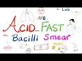 Acid Fast Bacilli Smear AFB smear for tuberculosis TB Labs