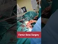 Download Lagu Live Femur Bone Surgery | जांघ की हड्डी का ऑपरेशन | #femur #bonefracture #surgeon #surgery #tips