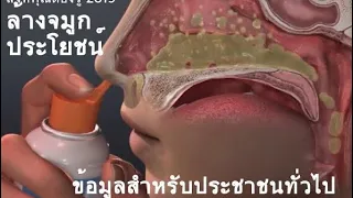 การล้างจมูกช่วยลดอาการไอได้อย่างไร และมีข้อดีอะไรบ้าง