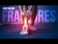 Apollo Hospitals Immediate Care for Broken Bones What to Do First Aid Tips
