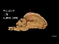 sheep brain dissection structures review for anatomy practical exam