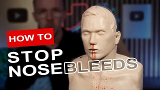 How to Stop a Nosebleed FAST (Step-by-Step First Aid Guide)