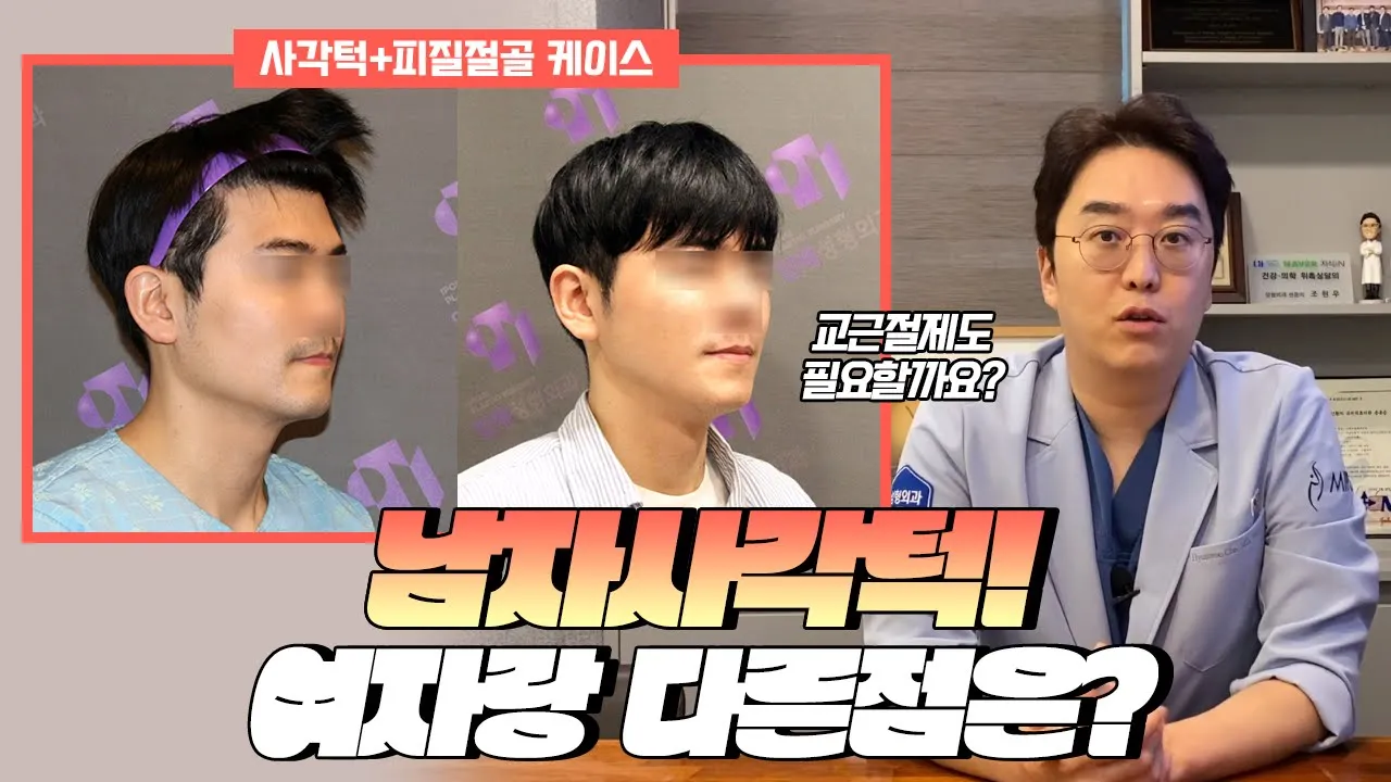 남자사각턱! 여자랑 다른 점은? 남자 사각턱수술 알아보기