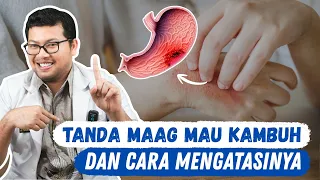 Ciri Ciri Sakit Maag Mau Kambuh dan Cara Cepat Mencegahnya - DOKTER SADDAM ISMAIL