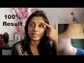 Remove Skin Tags in 1 Night 3 Amazing Way to Remove Skin Tags Preventing Naturally Soumali