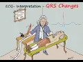 ECG Interpretation QRS Changes Part VI