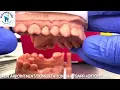 9 UNIT ZIRCONIA ‼️ UNBOXING ALERT! 🎉 Delhi Dentist Reveals Stunning Zirconia Crown! 😍@BeingDental