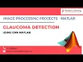 Glaucoma Detection using CNN Matlab