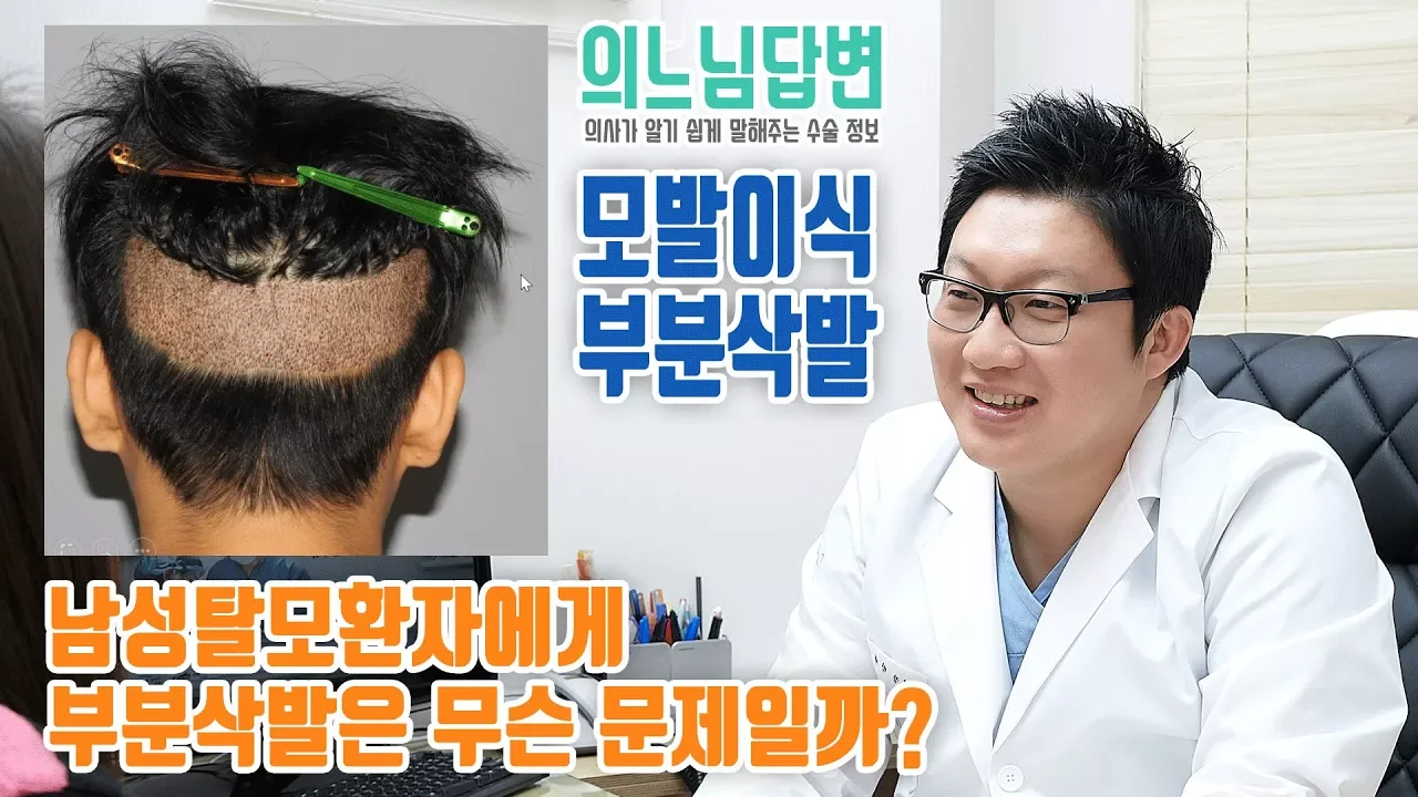 의느님답변📂ㅣ남성탈모환자에게 부분삭발은 무슨문제일까?