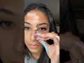 Let s peel off these pimple patches