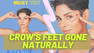 how to prevent and reverse crows feet and wrinkles around eyes