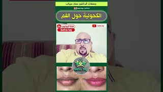 التخلص من الكحولية حول الفم مع الدكتور عماد ميزاب                      دندنها