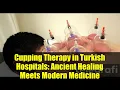 Download Lagu Cupping Therapy in Turkish Hospitals: Ancient Healing Meets Modern Medicine