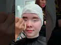 Albino girl s stunning transformation into a brunette