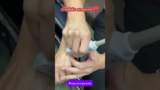  อาการเจ็บที่นิ้วมือและข้อมือ อาจเกิดจากสาเหตุอะไรบ้าง 