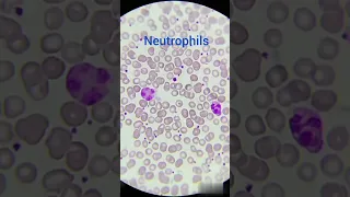 شكل Neutrophils في Blood Film فيلم الدم DrNouraElHanafy 