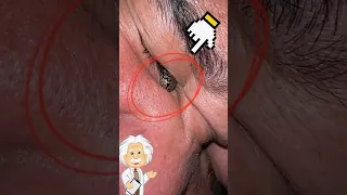 شيء غريب علق في عين هذا الرجل صدددمه Shorts 