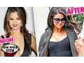 SELENA GOMEZ Boob Job Breast Implant Rumors Plastic Surgeons Respond